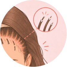 Breakage during adhesive removal